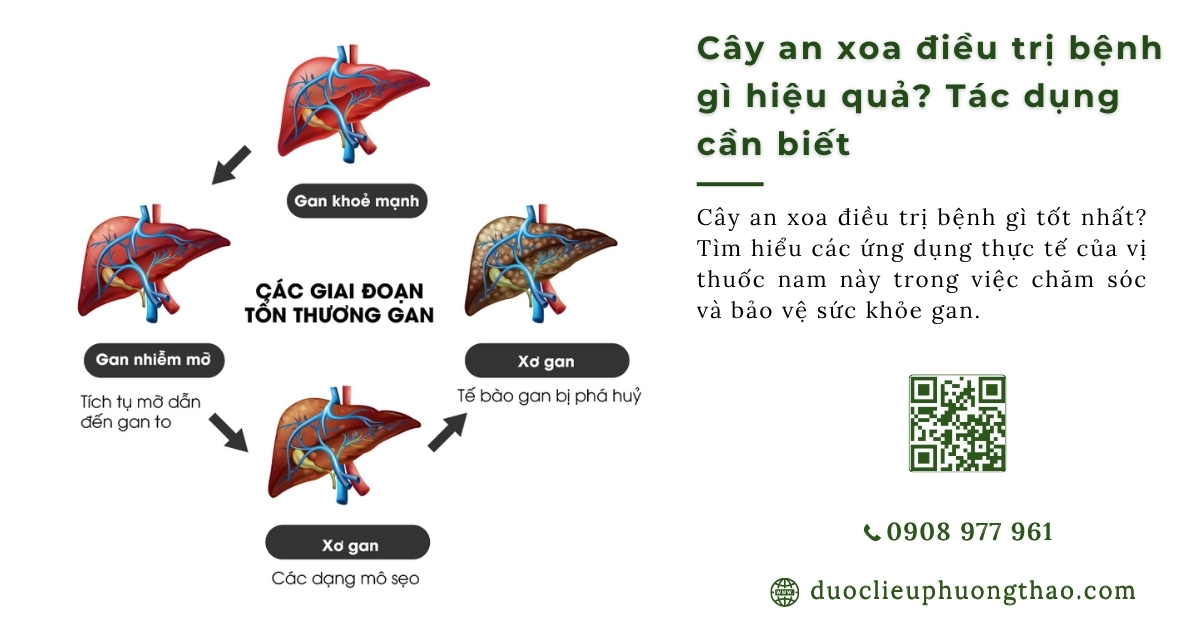 Cây an xoa điều trị bệnh gì? Có dứt điểm được bệnh gan không?