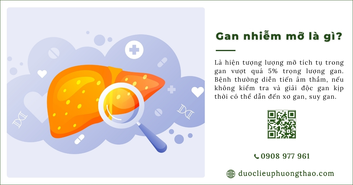 Gan nhiễm mỡ là gì? Vì sao chất béo có thể tích tụ trong gan?