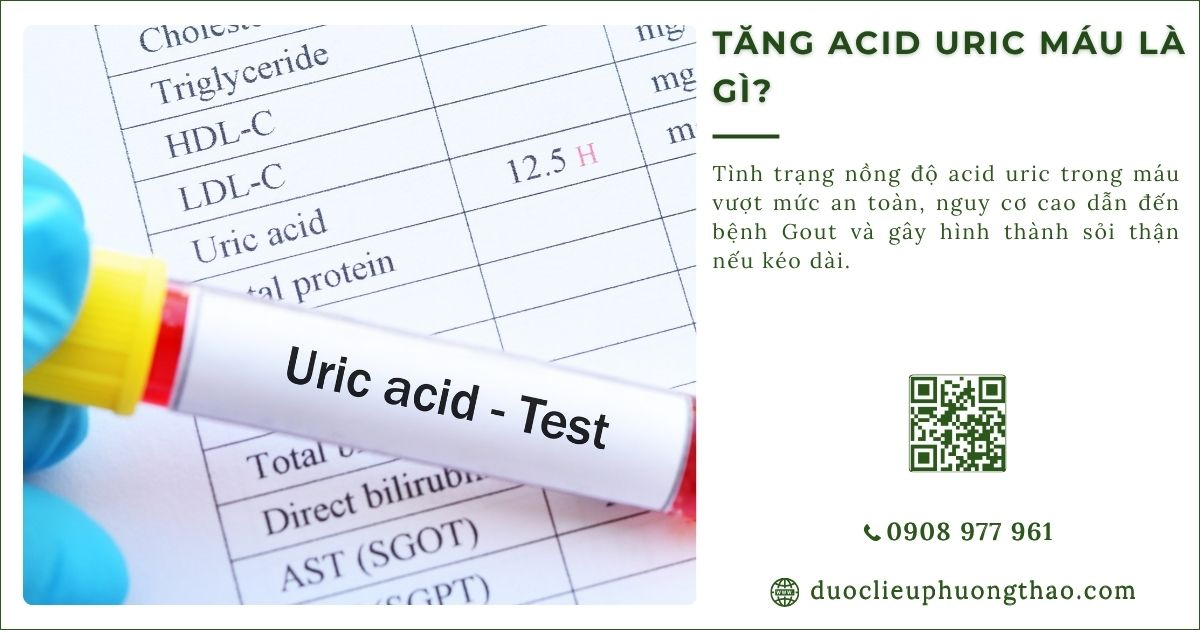 Tăng axit uric máu là gì? Nguyên nhân, nguy cơ và cách kiểm soát hiệu quả